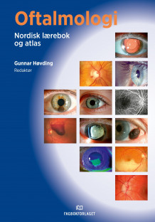 Oftalmologi av Gunnar Høvding (Ebok)